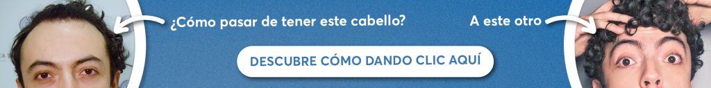 Mejor clínica de injerto de cabello
