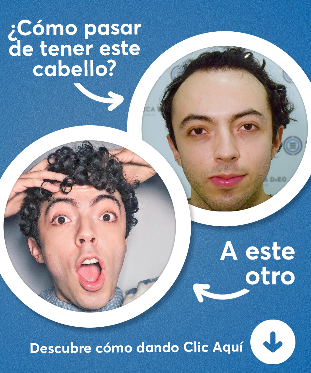 spot_img